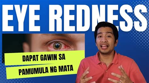 gamot sa nagluluha ang mata|Pamumula ng Mata, Ano nga ba ang Sanhi .